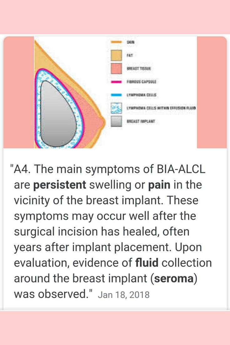 National Breast Implant Awareness Month - Graphic